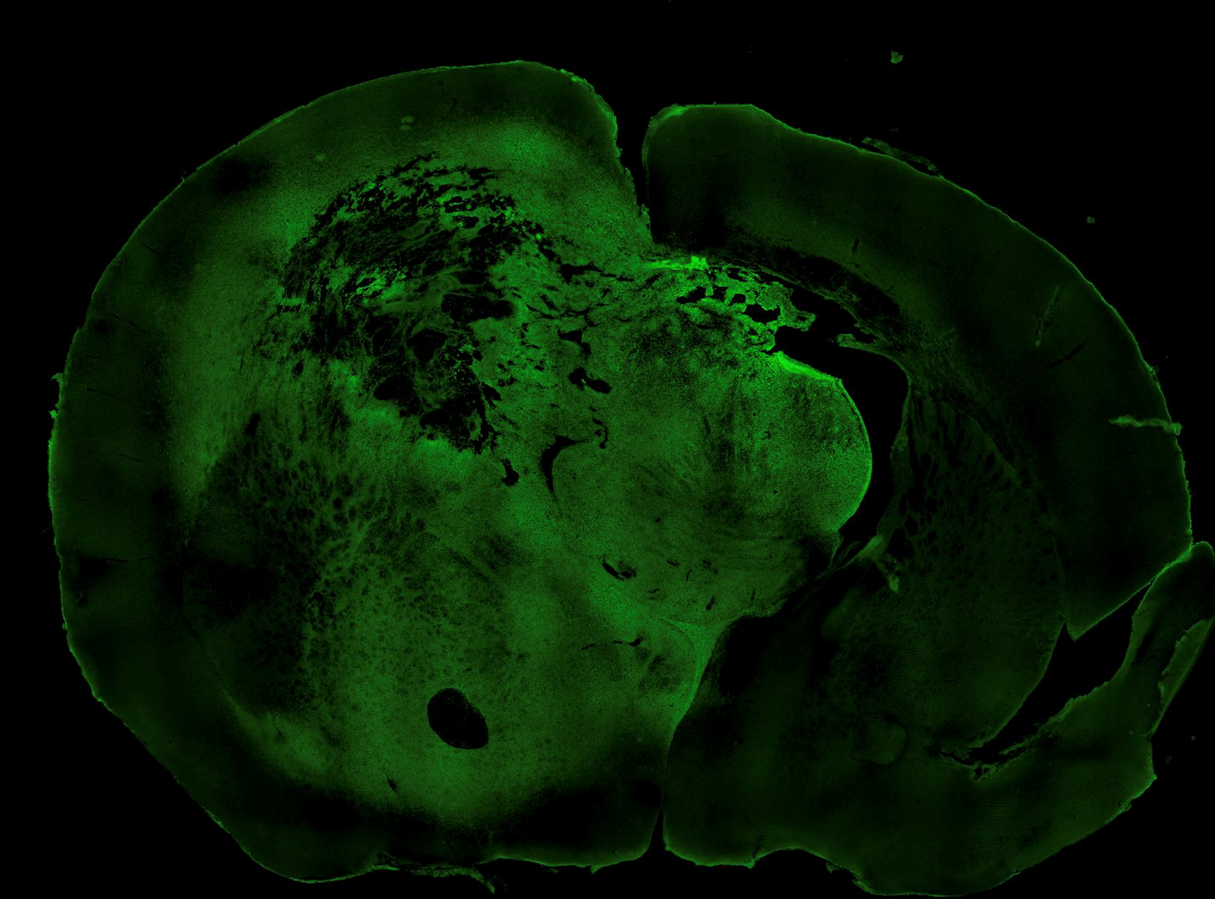 Green fluorescent coronal brain section from the mEGFRvIII glioma model